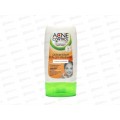Acne Control Pro Гель для умывания Глубокоочищающий 150мл *12